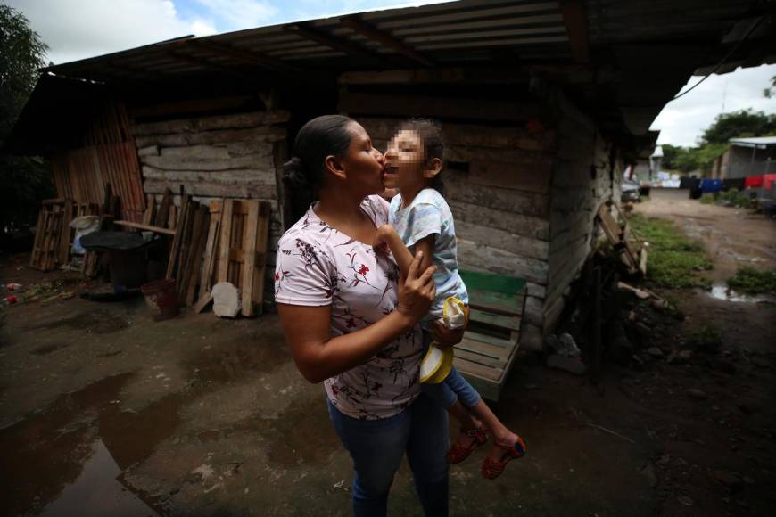 Los hijos del zika sobreviven en medio de la calamidad: las historias no contadas