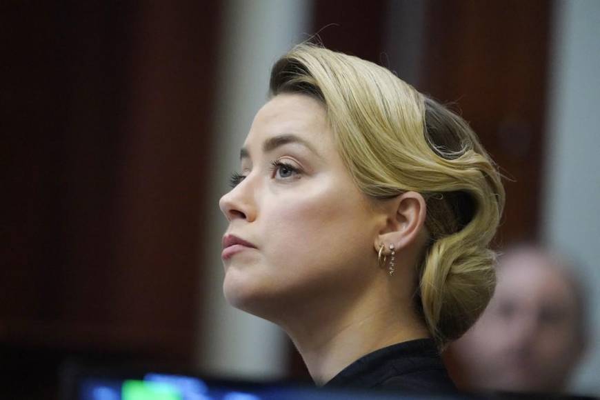 El trastorno histriónico de la personalidad, el padecimiento que podría tener Amber Heard