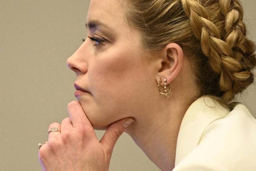 El trastorno histriónico de la personalidad, el padecimiento que podría tener Amber Heard