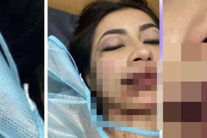 Fue brutalmente golpeada por su pareja en San Pedro Sula: ¿qué sabemos del caso de la tiktoker colombiana Daniela Aldana?