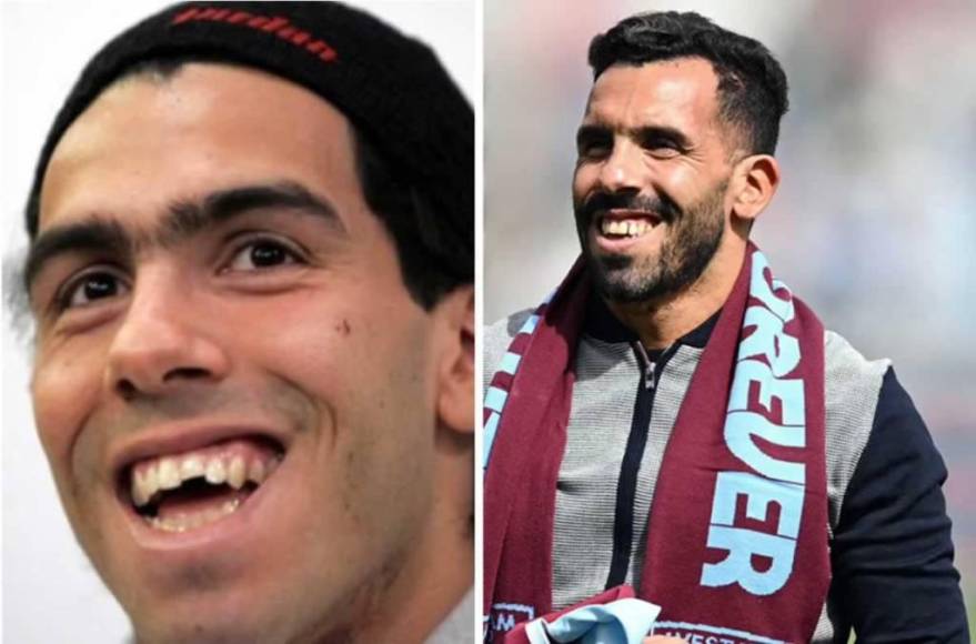 El antes y después de los deportistas internacionales que arreglaron sus dientes