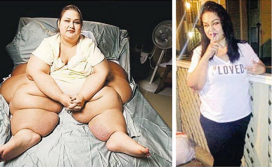 ¿Qué ha sido de Mayra Rosales, “la mujer más obesa del mundo”?