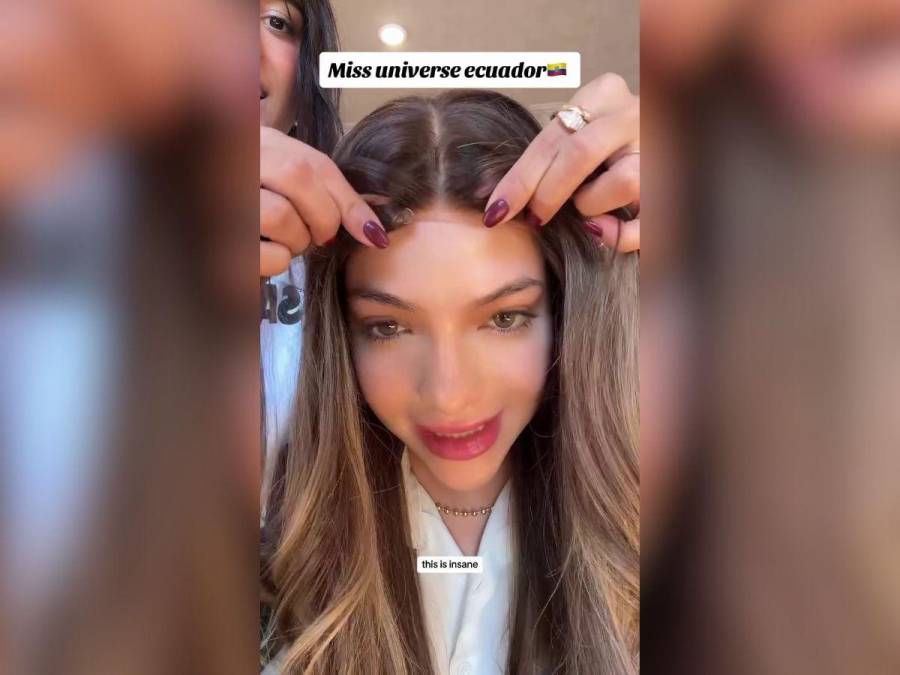 Mara Topic, la Miss Ecuador que lucha contra la calvicie causada por una enfermedad