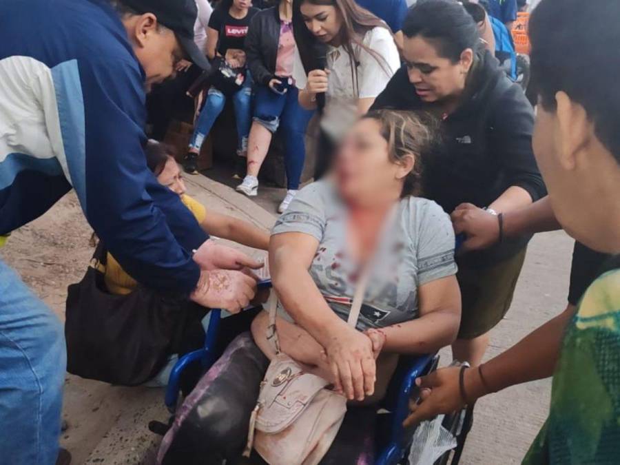 Rostros ensangrentados y cuerpos lesionados: las imágenes que dejó accidente de bus en la capital