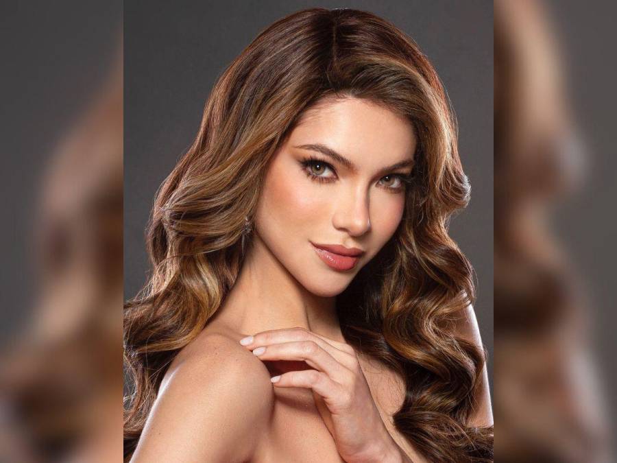 Mara Topic, la Miss Ecuador que lucha contra la calvicie causada por una enfermedad