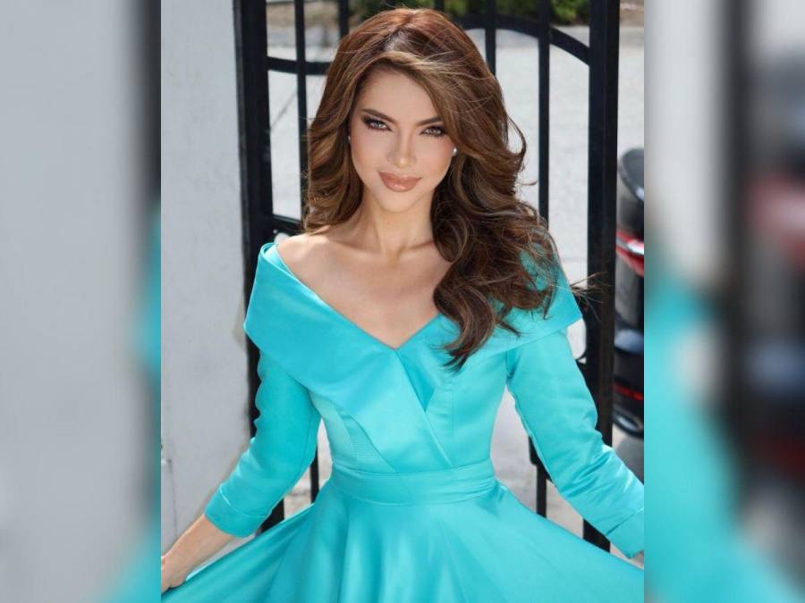 Mara Topic, la Miss Ecuador que lucha contra la calvicie causada por una enfermedad