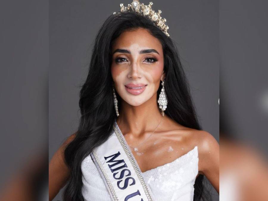 Logina Salah, la primera Miss Egipto con vitiligo, busca coronarse en el Miss Universo 2024