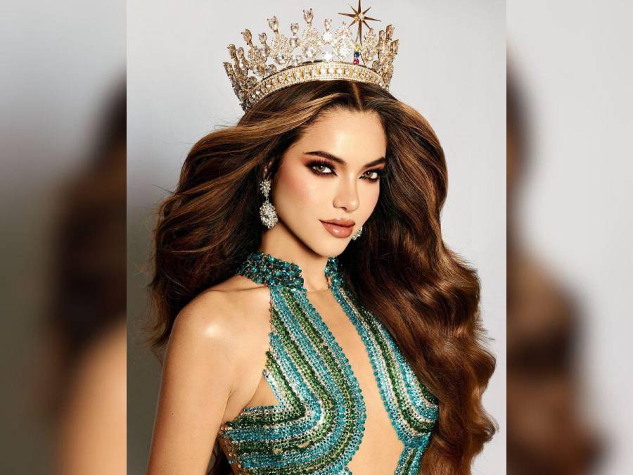 Mara Topic, la Miss Ecuador que lucha contra la calvicie causada por una enfermedad