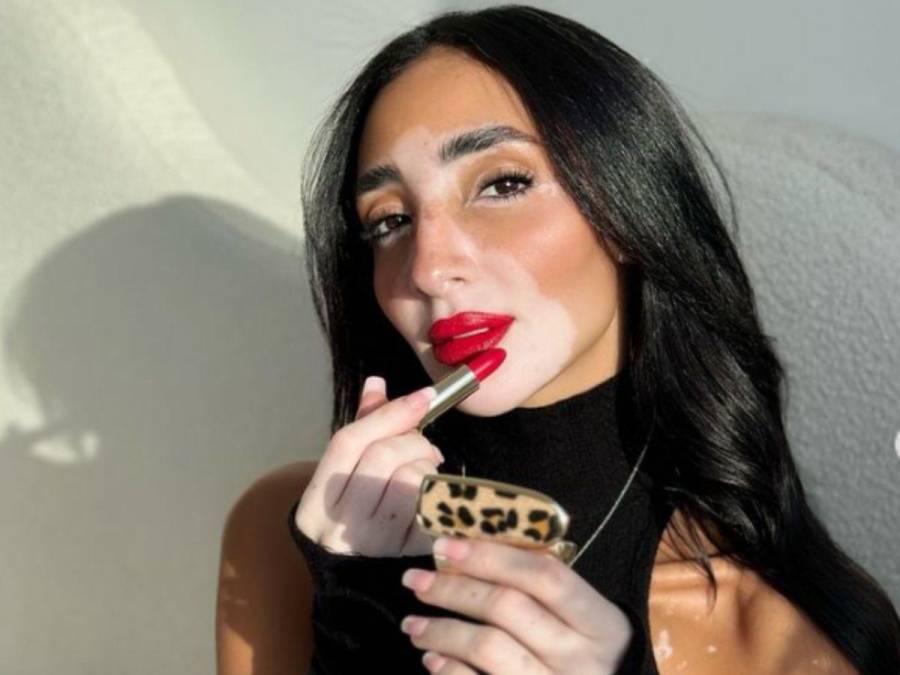 Logina Salah, la primera Miss Egipto con vitiligo, busca coronarse en el Miss Universo 2024