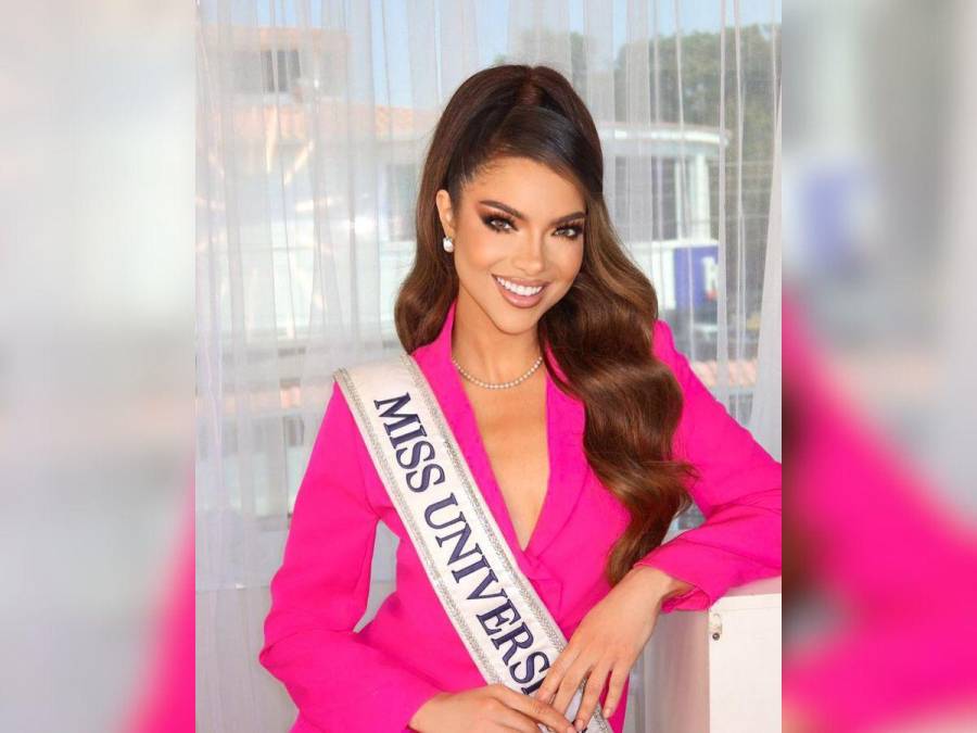 Mara Topic, la Miss Ecuador que lucha contra la calvicie causada por una enfermedad