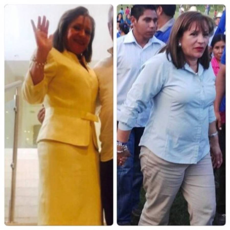 Antes y después de la diputada Gladis Aurora López