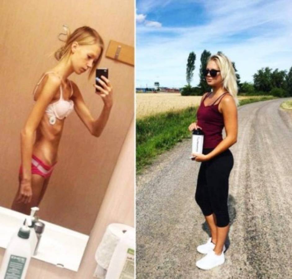 Superación: La joven que sufría anorexia y ahora es una sensual maestra de fitness