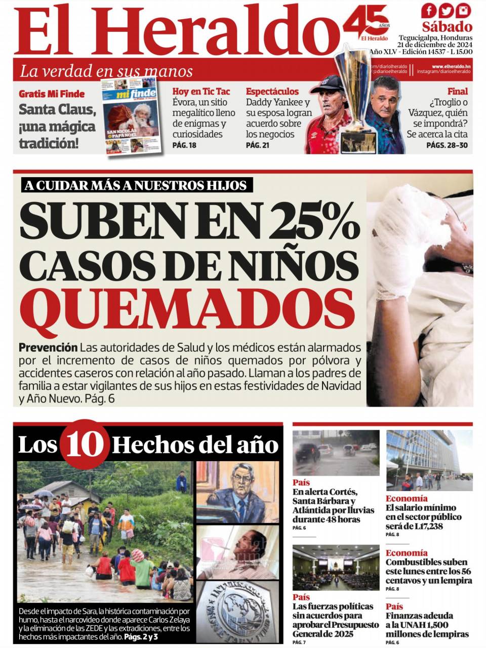 Suben en 25% casos de niños quemados