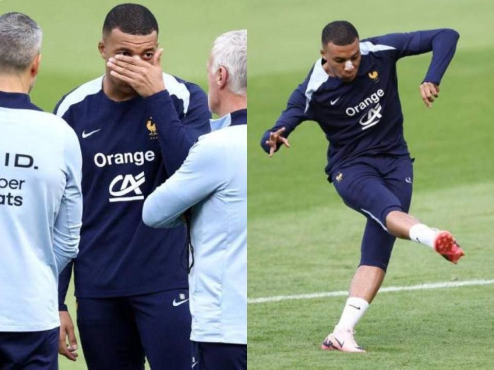 El capitán de los ‘Bleus’ apareció en el entrenamiento de la selección francesa luego de fracturarse la nariz hace dos días.