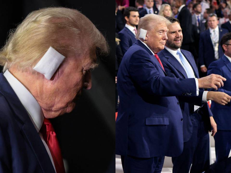 Luego de sobrevivir a un intento de asesinato en Pensilvania, Donald Trump acudió a la convención republicana en Wisconsin con su oreja vendada.