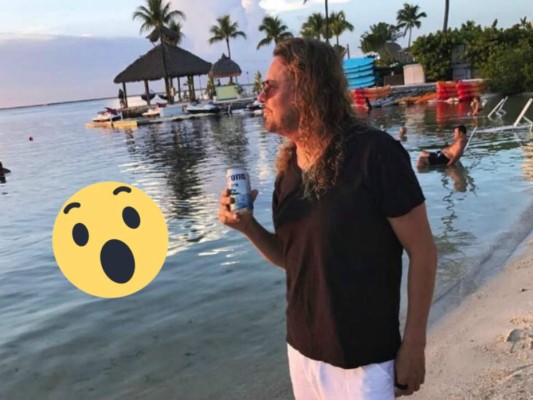 ¿Qué le pasó al rostro de Fher Olvera, vocalista de Maná?