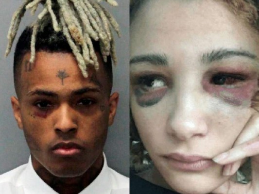 Ex novia de XXXTentacion revela las brutales golpizas que le daba el rapero